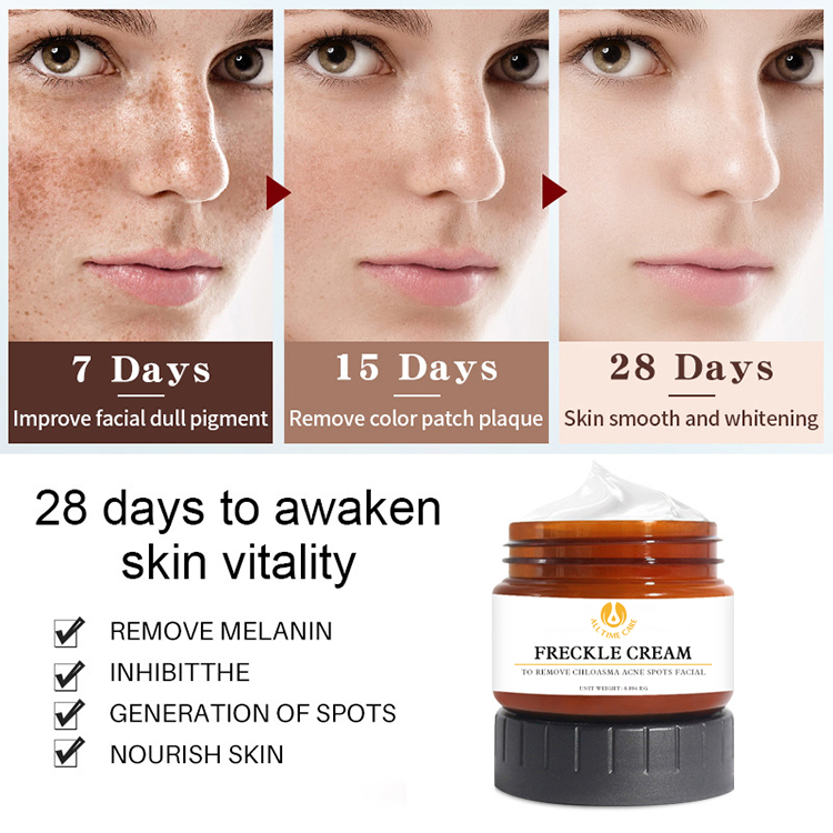 Freckle cream | ALLTIMECARE