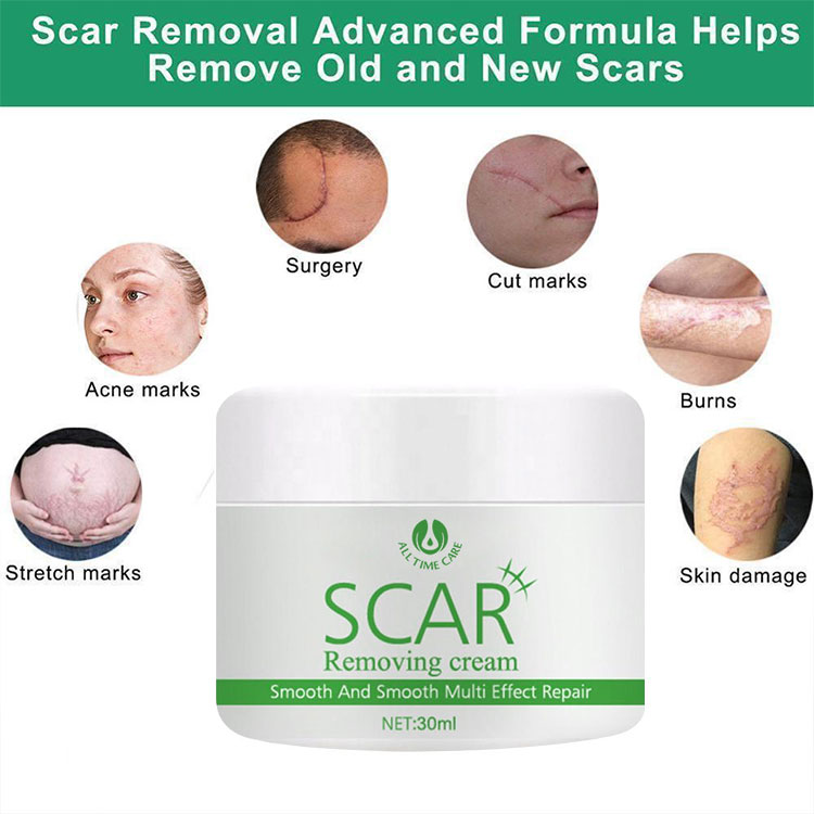 Scar Removing Cream | ALLTIMECARE